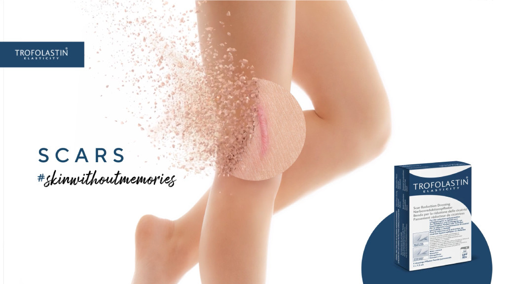 Trofolastin scars<br>#skinwithoutmemories