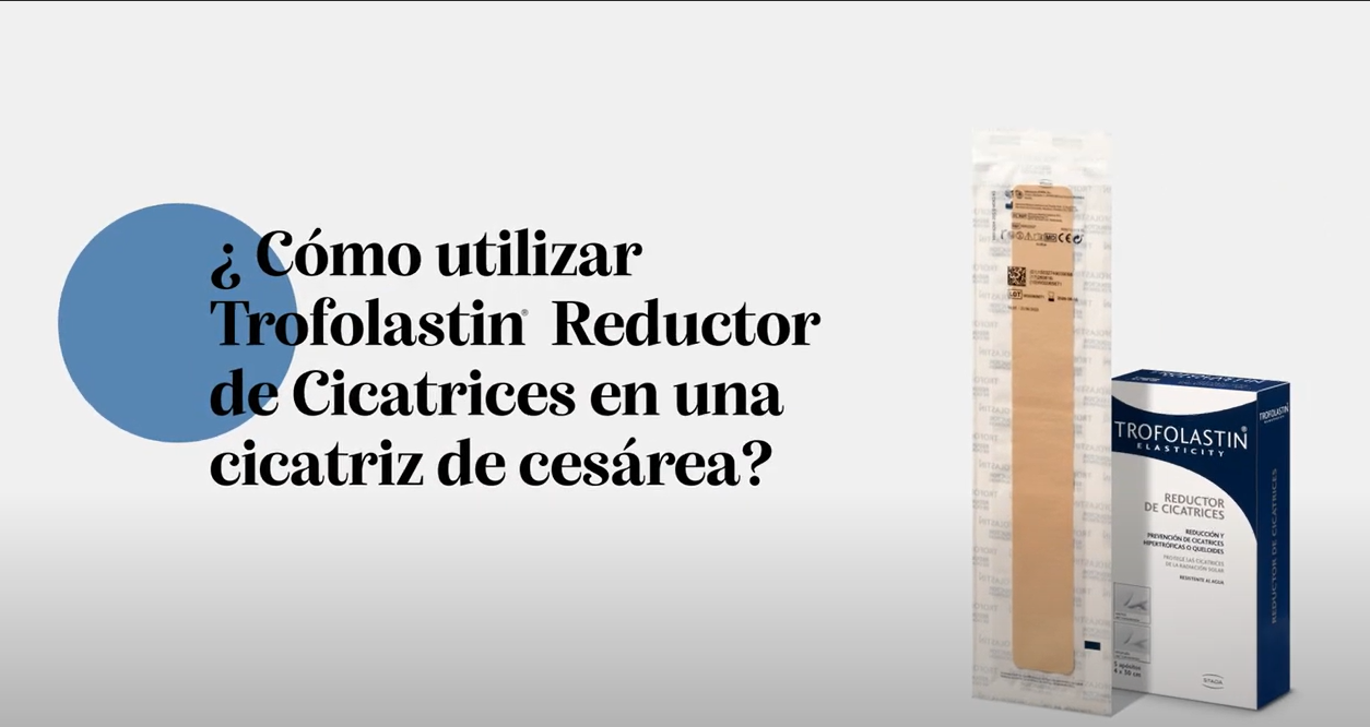 ¿Cómo reducir una cicatriz de cesárea?